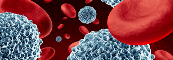Dietary Lifestyle For Hypertension in Scotts Valley CA