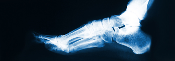 Chiropractic Scotts Valley CA XRays Chiropractic Scotts Valley CA XRays